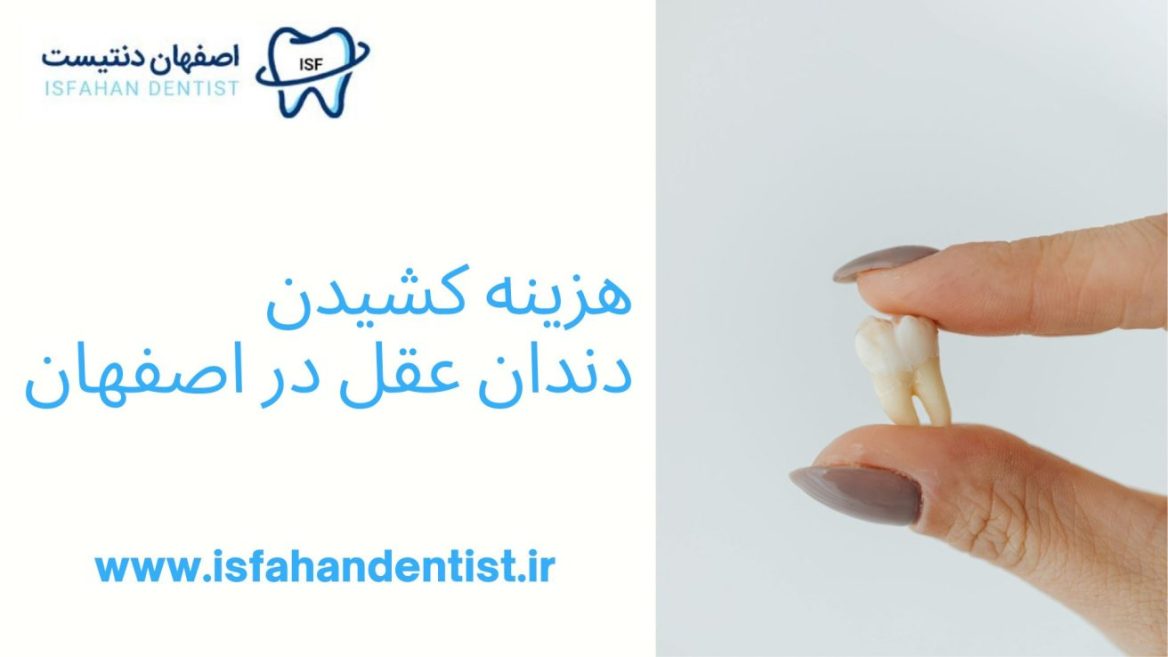 قیمت کشیدن دندان عقل در اصفهان