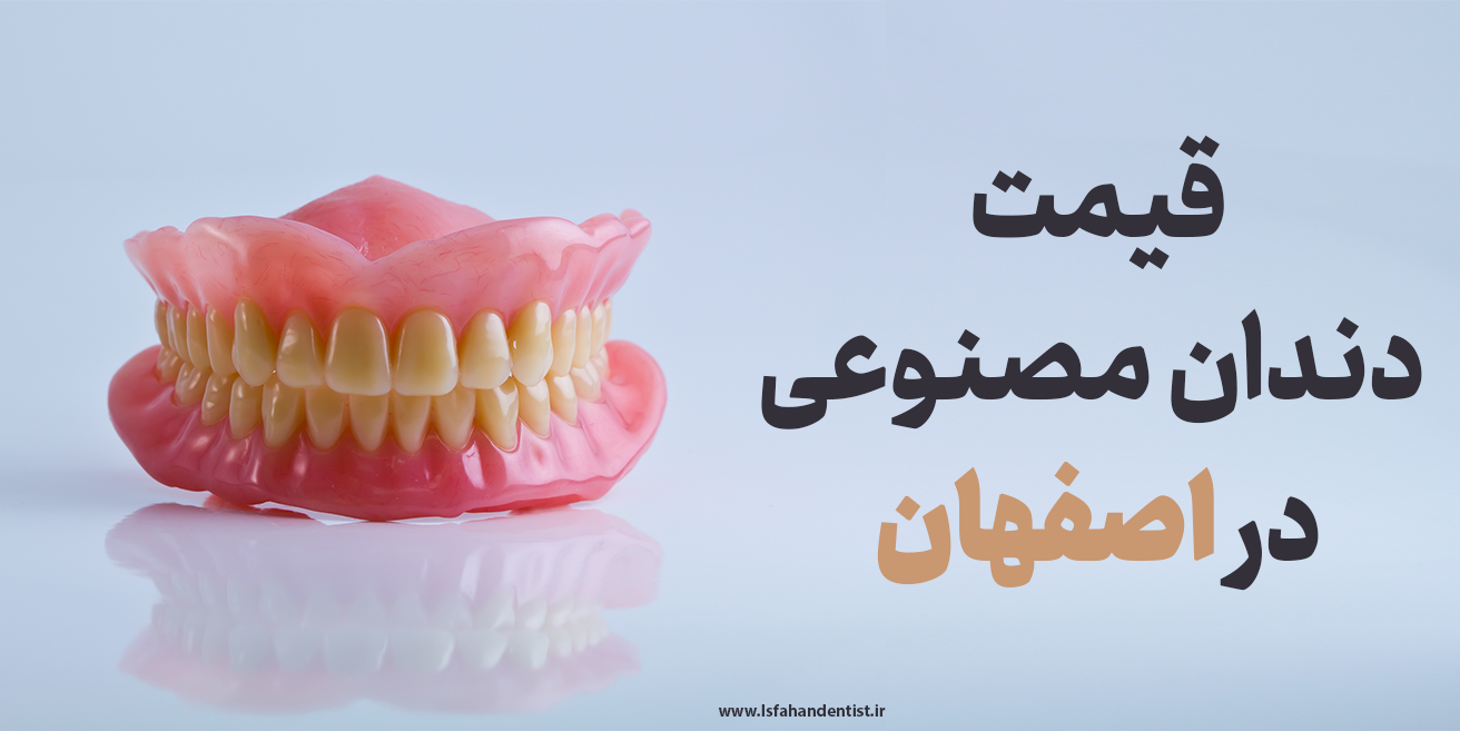 قیمت دندان مصنوعی در اصفهان